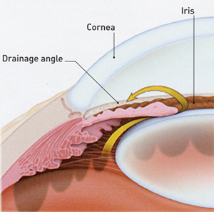 drainage angle2