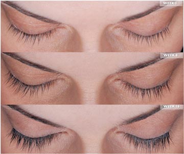 Latisse for Eyelash Growth - South Bay Ophthalmology